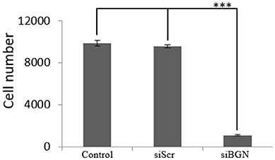 Biglycan Regulates MG63 Osteosarcoma Cell Growth Through a LPR6/β-Catenin/IGFR-IR Signaling Axis